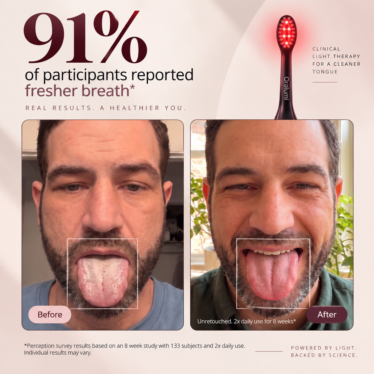 Oralumi Red + Blue Light Toothbrush