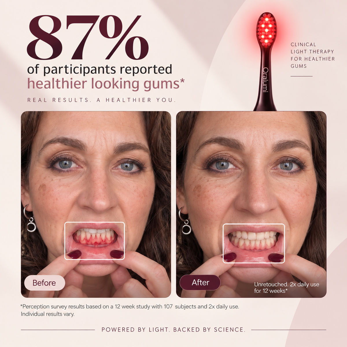 Oralumi Red + Blue Light Toothbrush