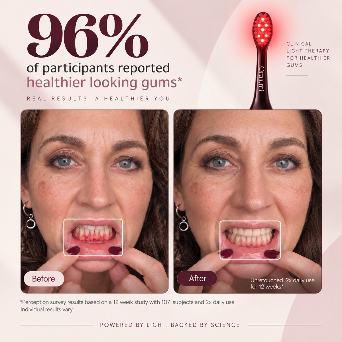 Oralumi Red + Blue Light Toothbrush