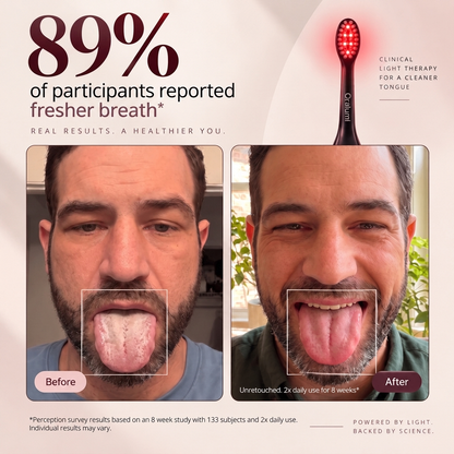 Oralumi Red + Blue Light Toothbrush